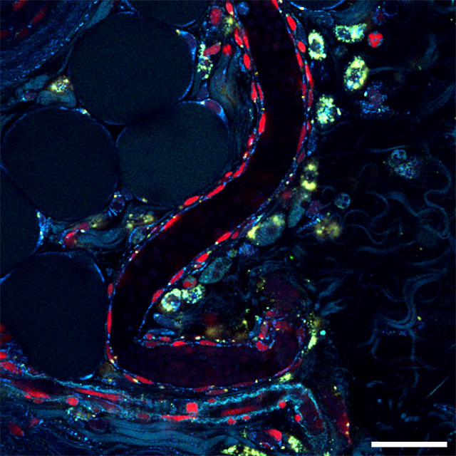 Multiphoton fluorescence imaging